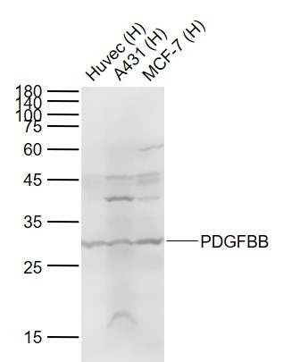 Anti-PDGF-BB Polyclonal Antibody 2