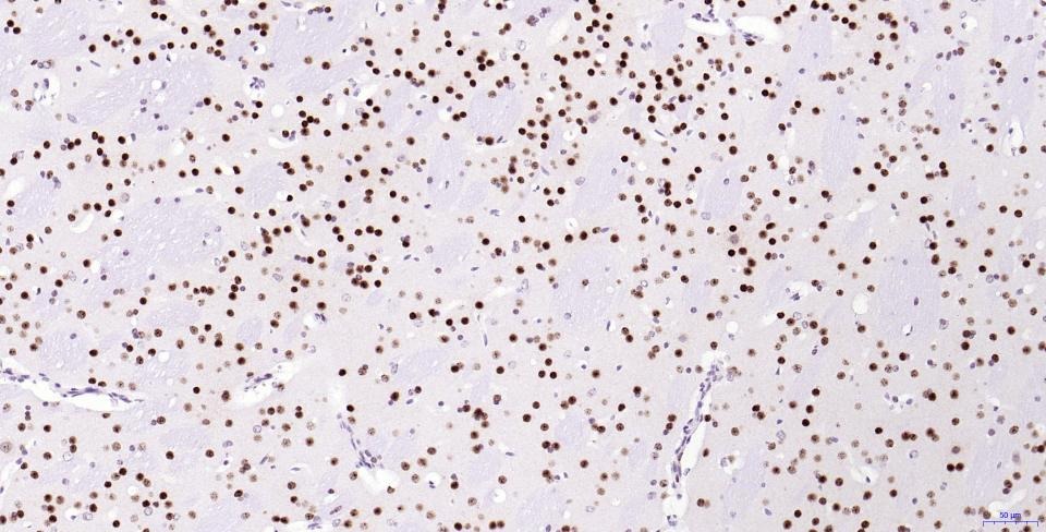 Anti-Phospho-H2AFX (Ser139) Antibody (2T270)