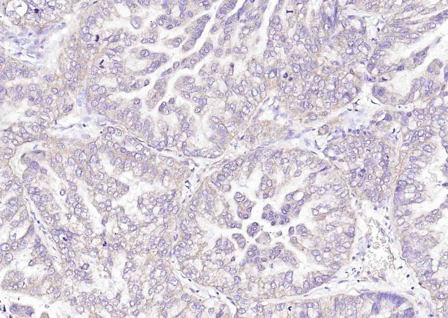 Anti-PDHA1 Polyclonal Antibody