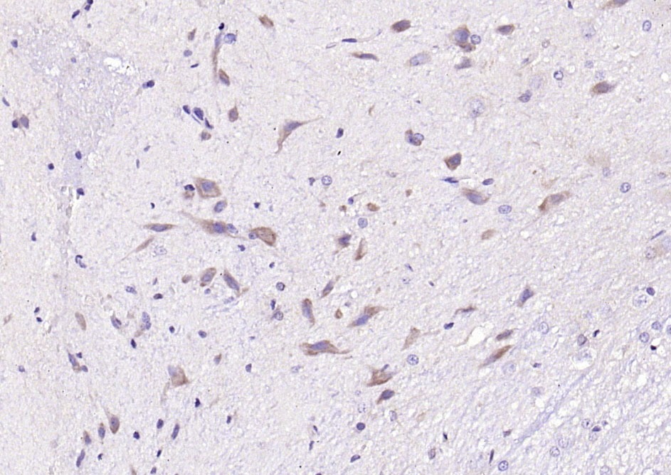Anti-PDK4 Polyclonal Antibody