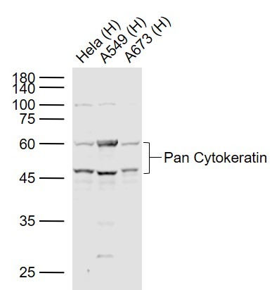 Anti-Pan Cytokeratin Polyclonal Antibody 2