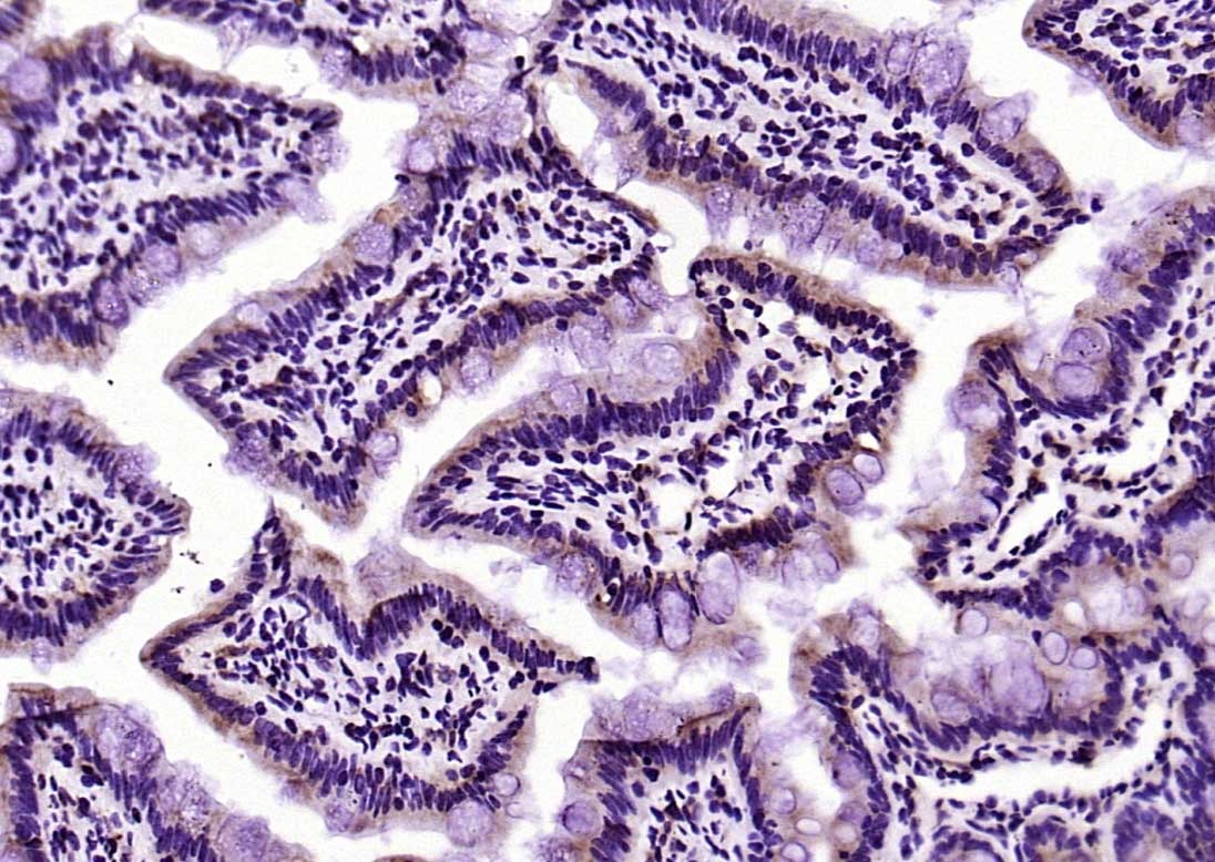 Anti-PEPT1 Polyclonal Antibody