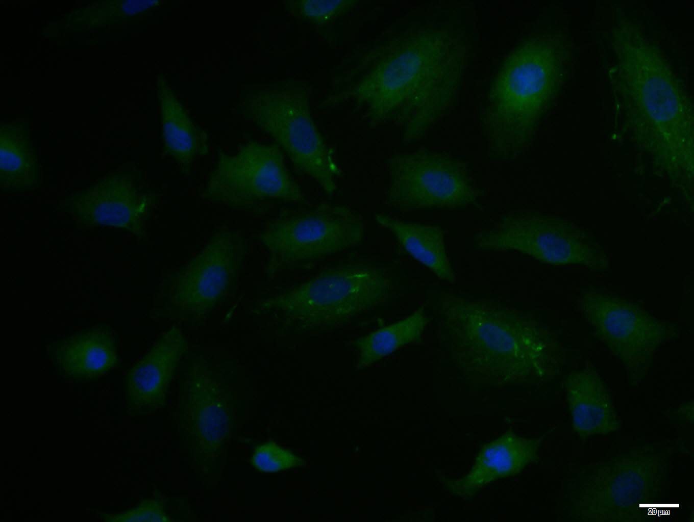 Anti-PAI-1 Polyclonal Antibody