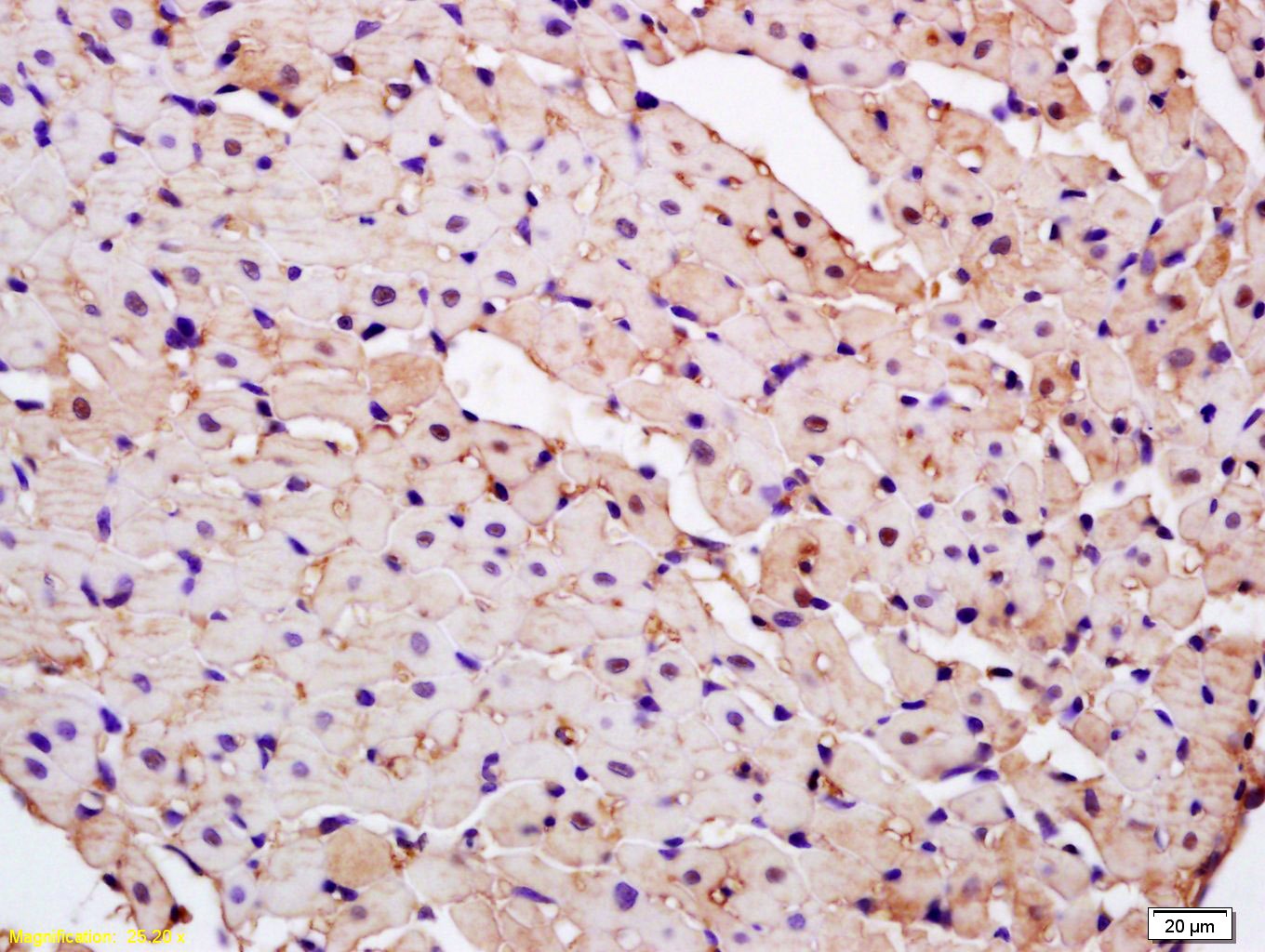 Anti-PARK7/DJ-1 Polyclonal Antibody