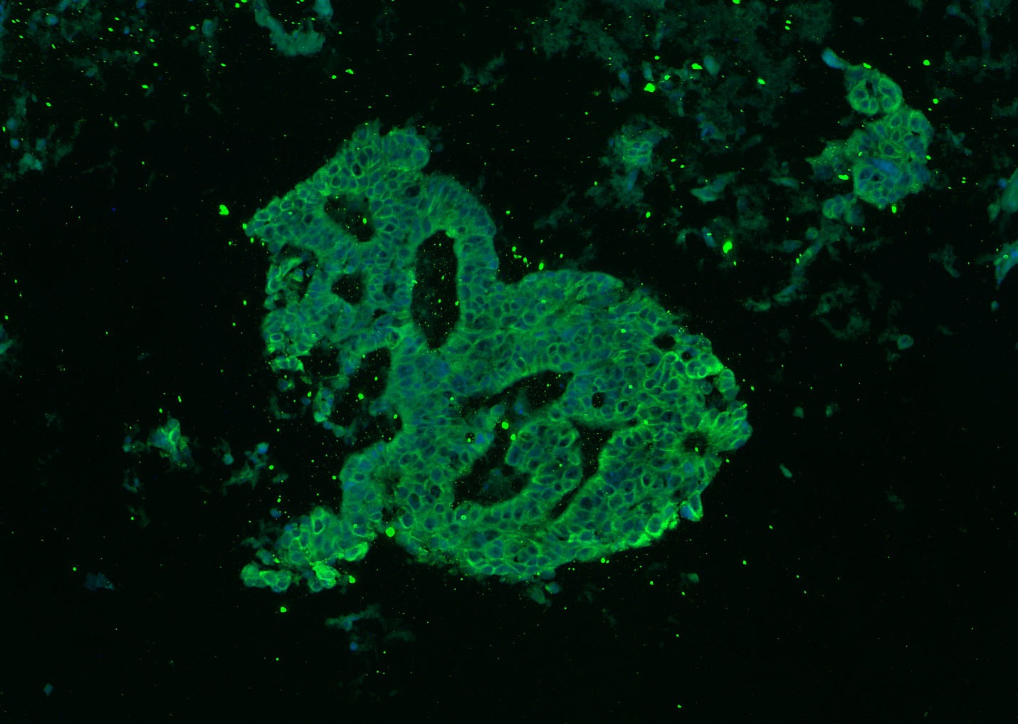 Anti-Pan Cytokeratin Polyclonal Antibody 2