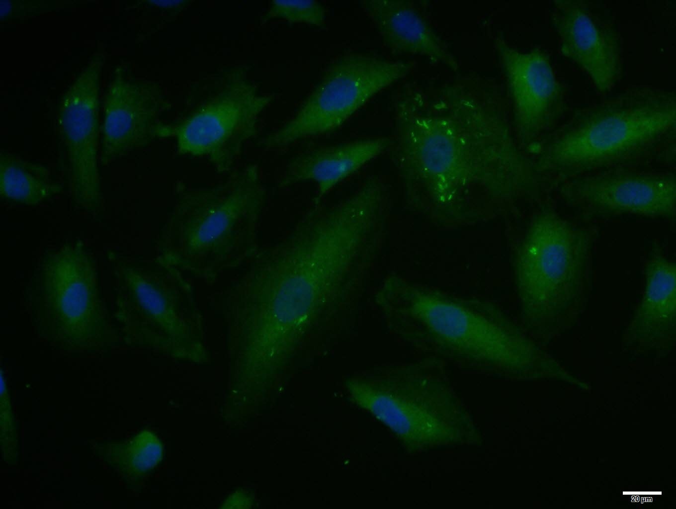 Anti-PAI-1 Polyclonal Antibody