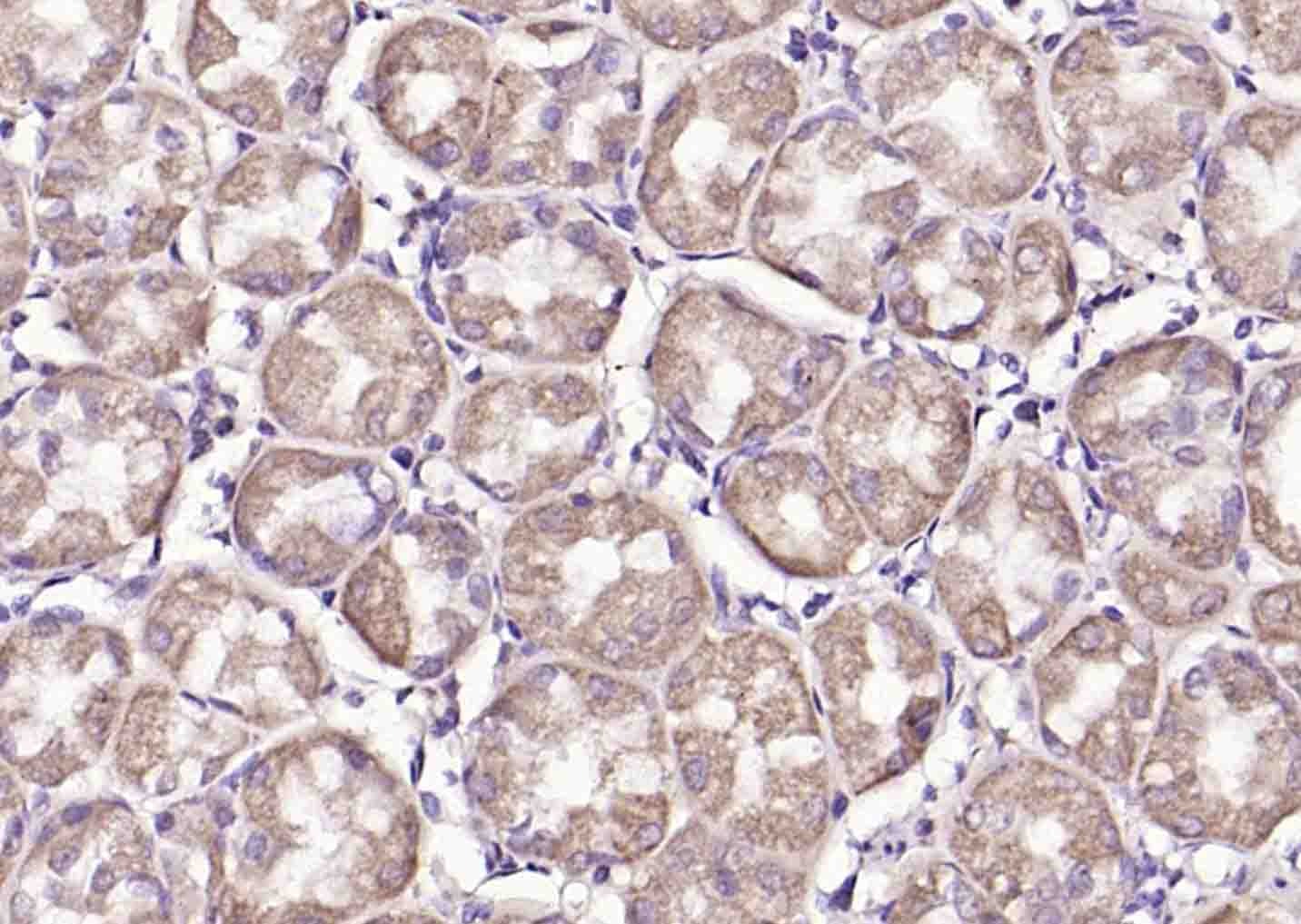 Anti-PDHA1 Polyclonal Antibody