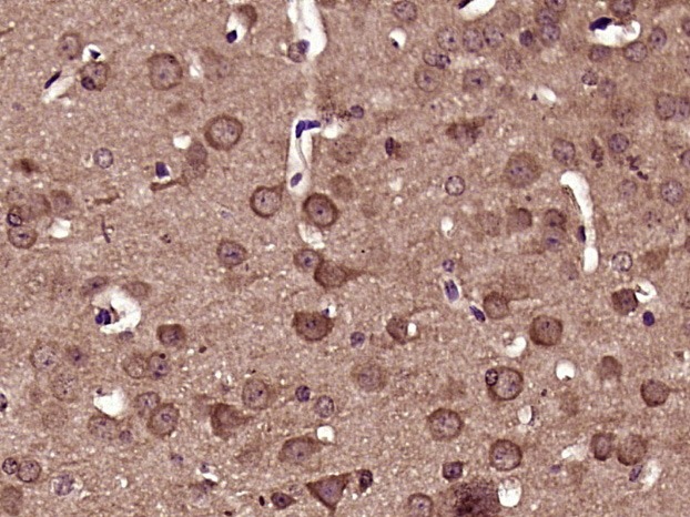 Anti-Phospho-DNM1L (Ser616) Polyclonal Antibody
