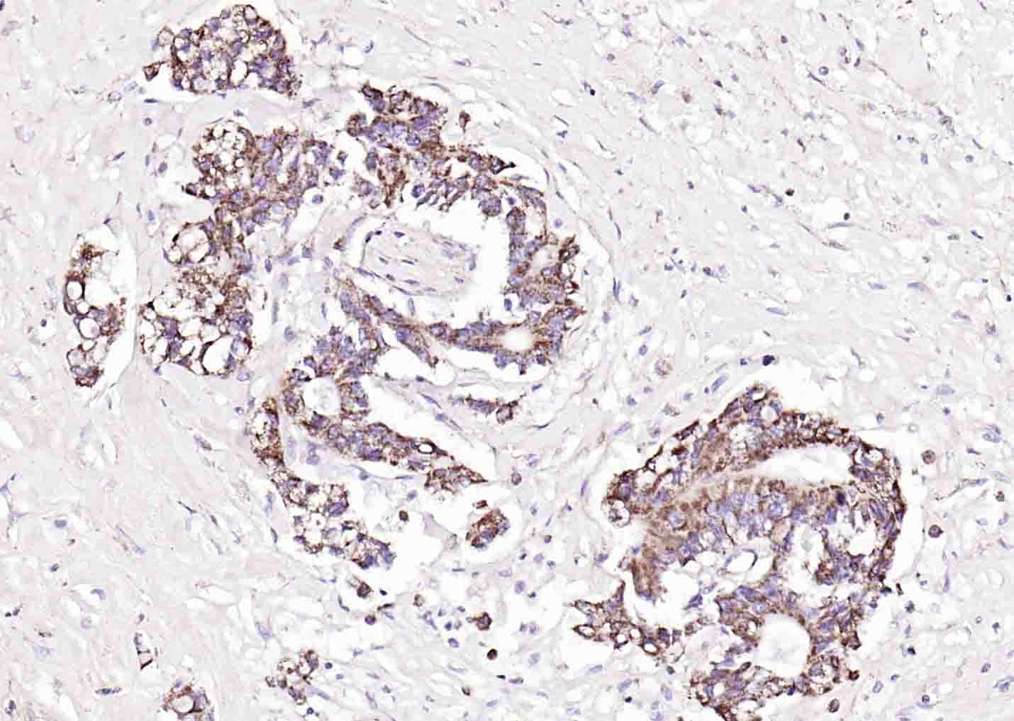 Anti-PAI-1 Polyclonal Antibody 2