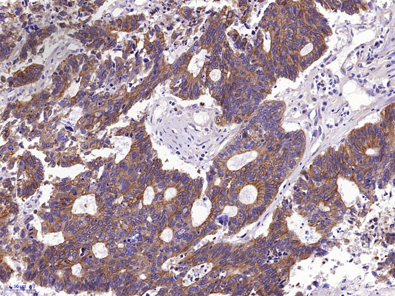 Anti-Pan Cytokeratin Polyclonal Antibody 2