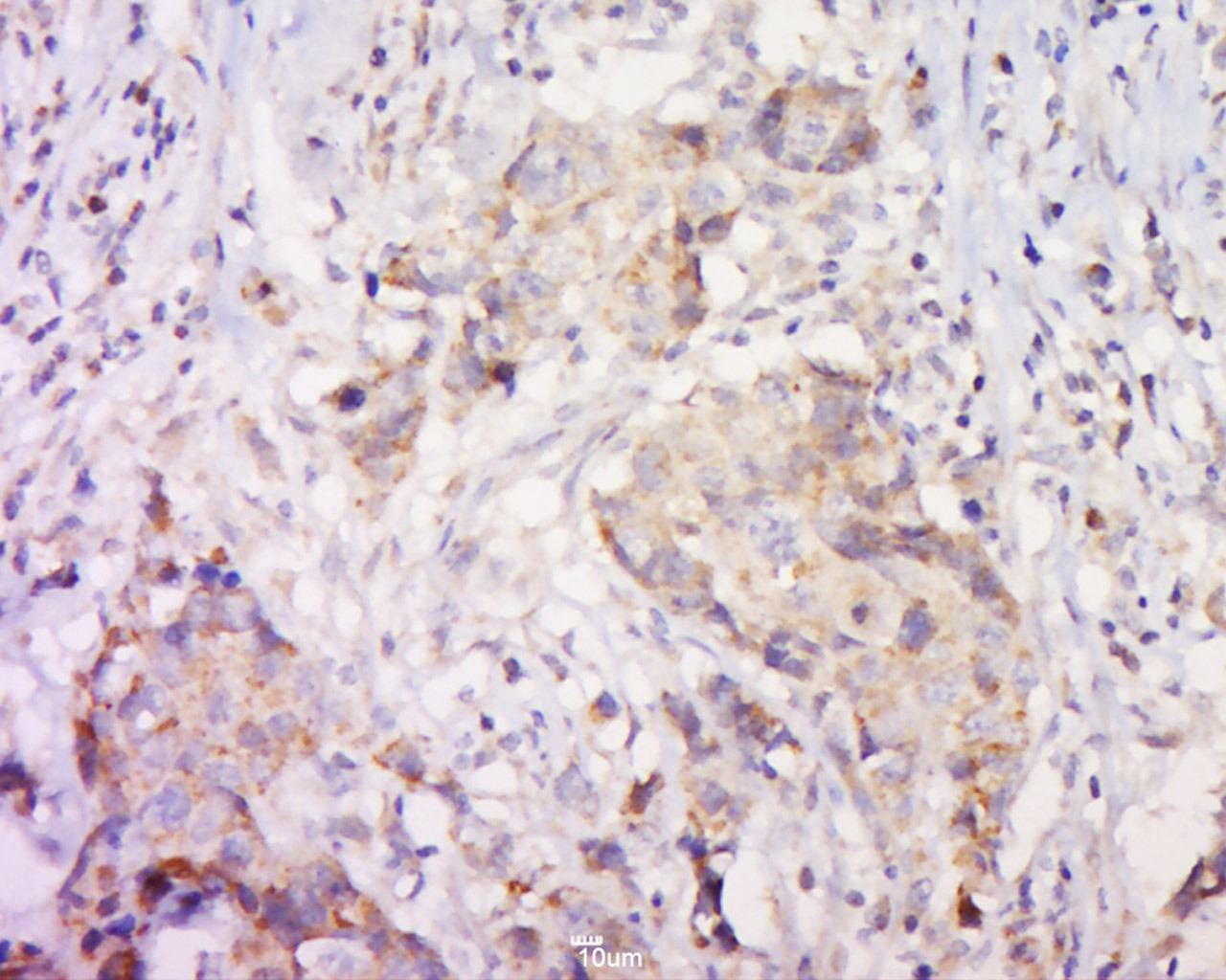 Anti-PAR2 Polyclonal Antibody