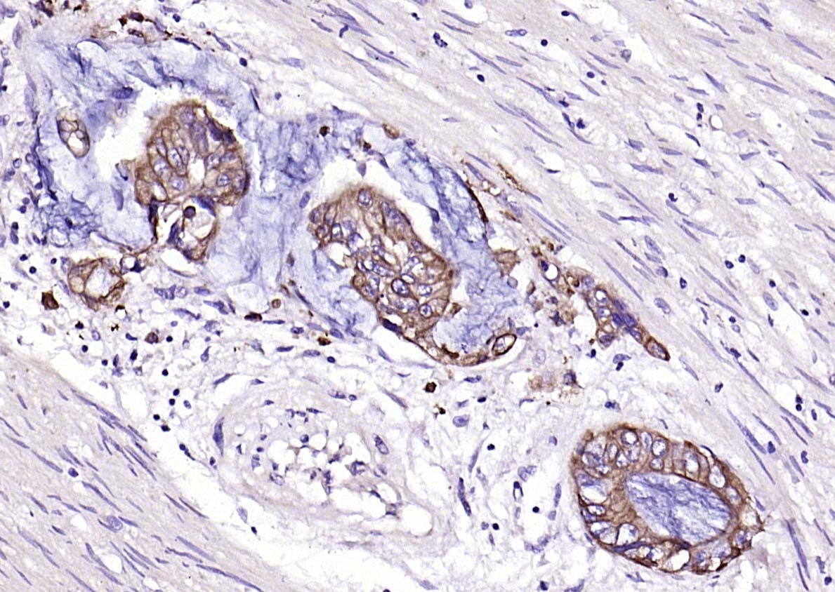 Anti-Pan Cytokeratin Polyclonal Antibody 2
