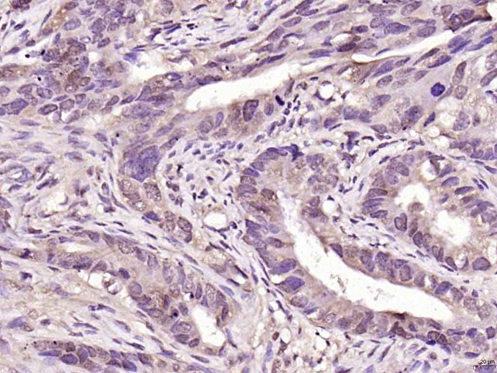 Anti-PARK7/DJ-1 Polyclonal Antibody