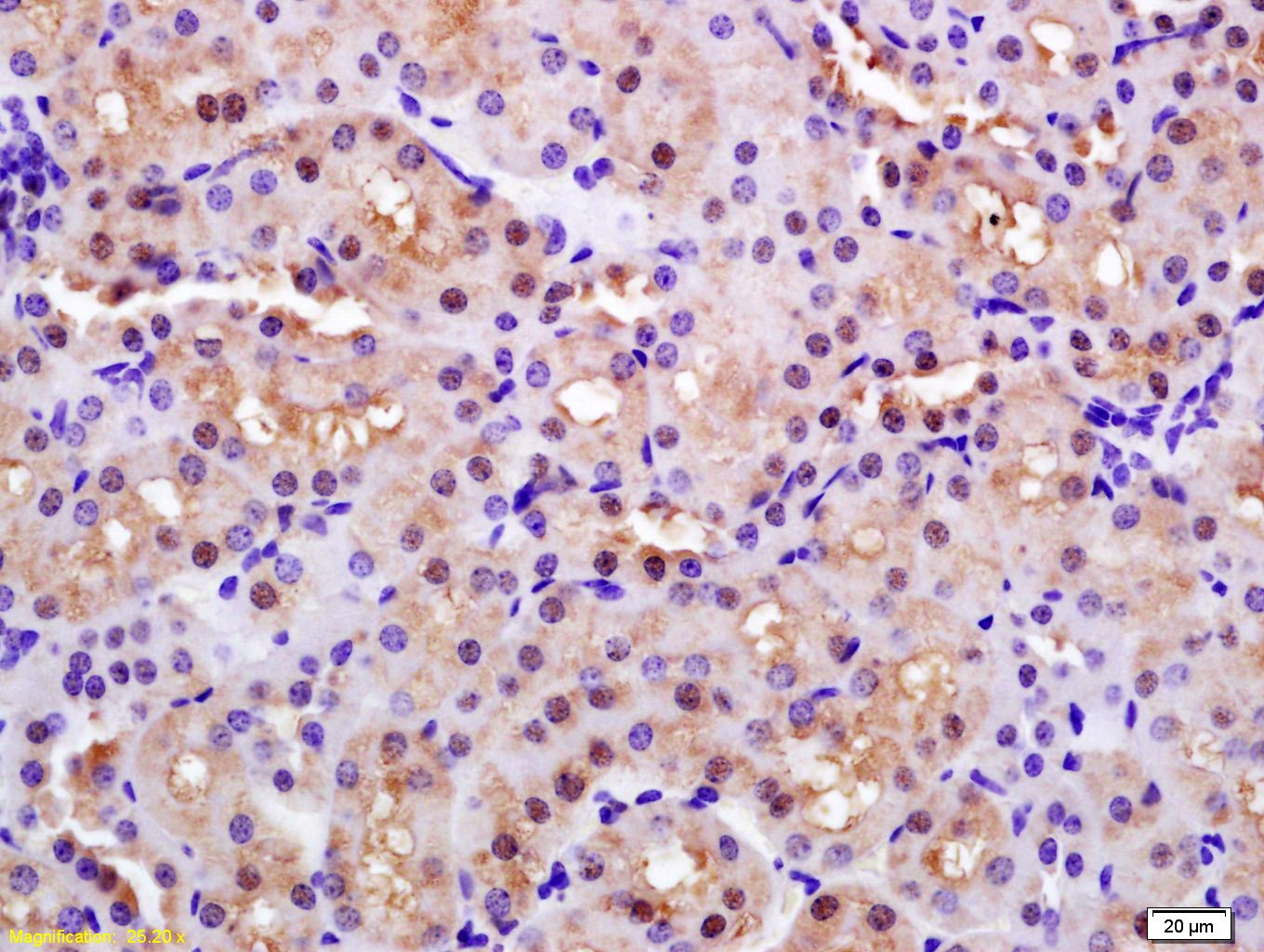 Anti-PARK7/DJ-1 Polyclonal Antibody