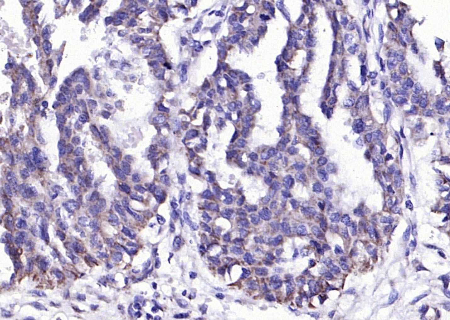 Anti-PAI-1 Polyclonal Antibody 2