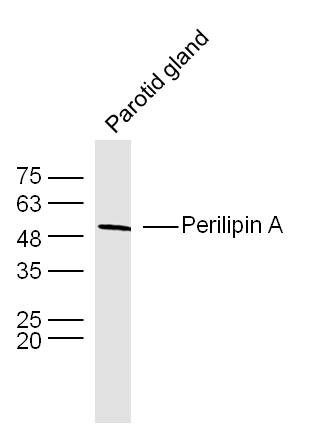 Anti-Perilipin A Polyclonal Antibody