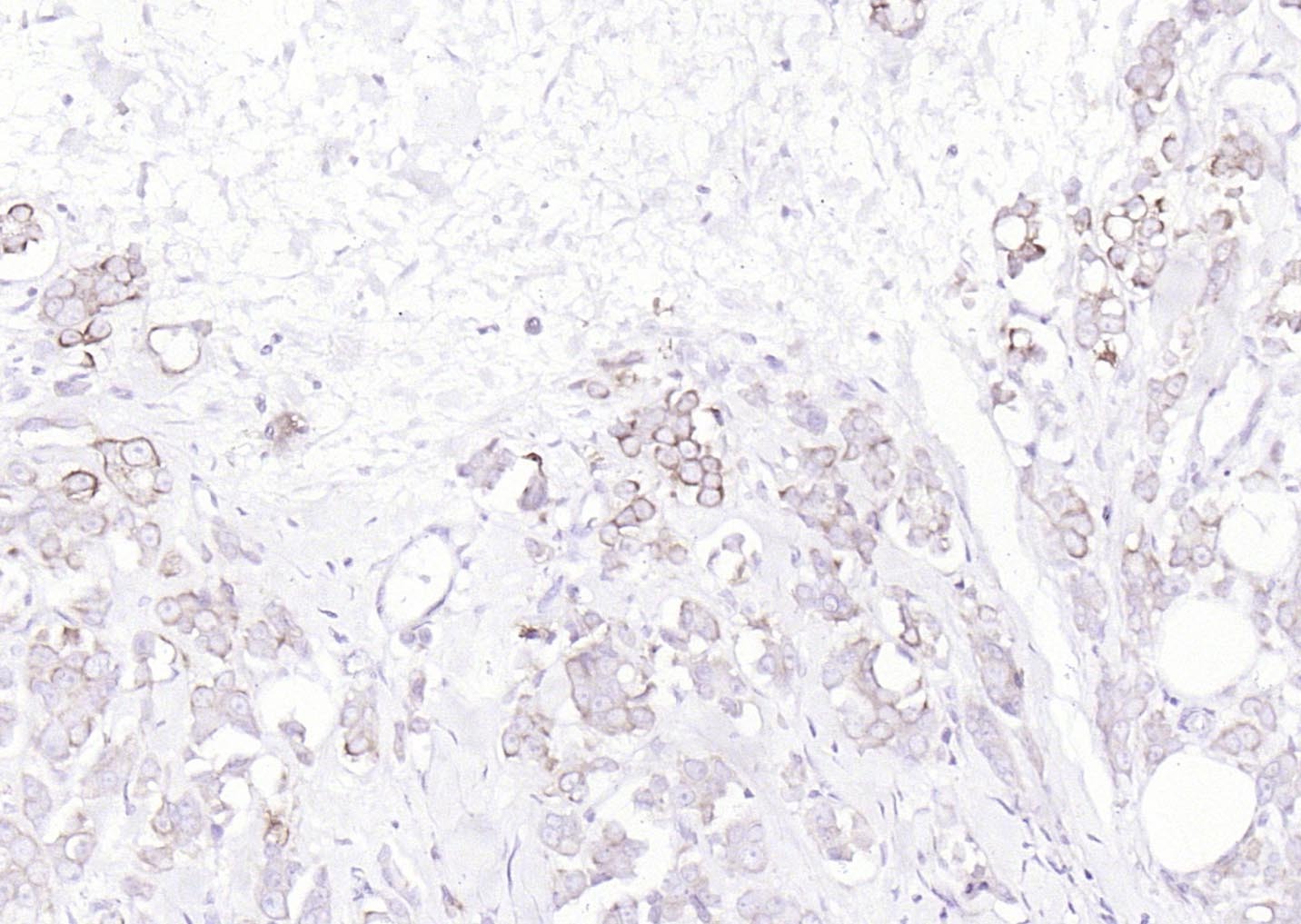 Anti-Pan Cytokeratin Polyclonal Antibody 2