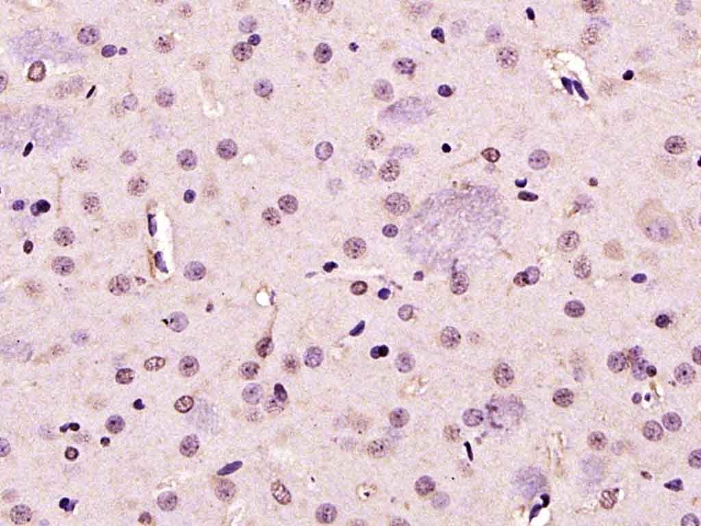 Anti-PARK7/DJ-1 Polyclonal Antibody
