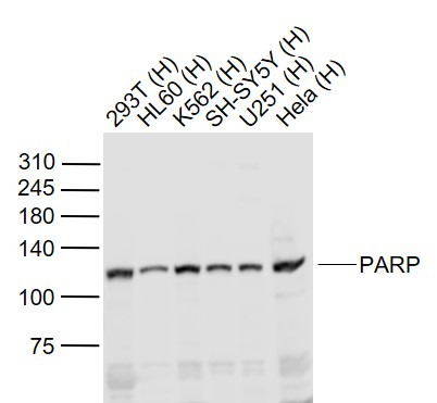 Anti-PARP1 Polyclonal Antibody 2