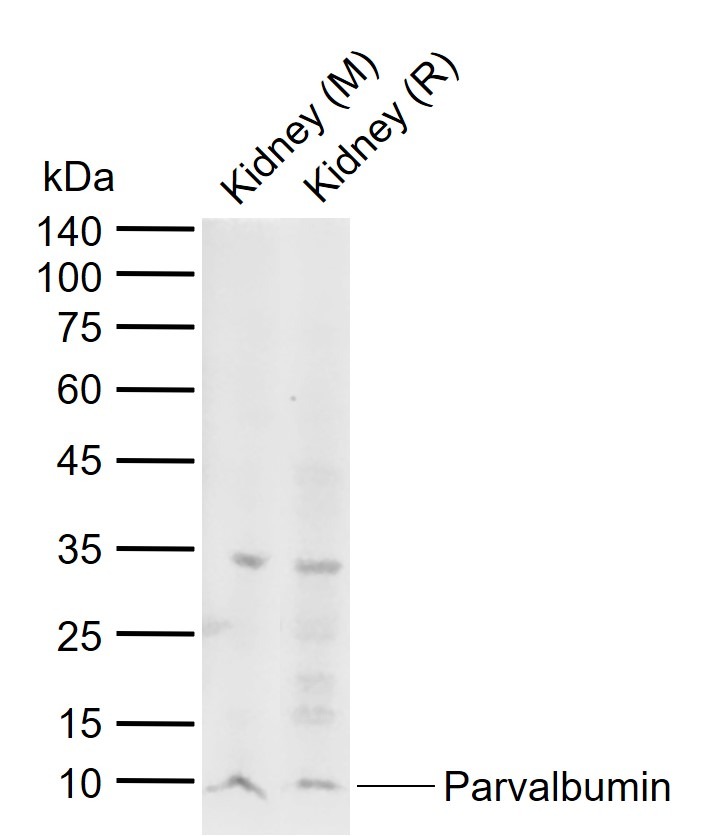 Anti-Parvalbumin/PVALB Polyclonal Antibody