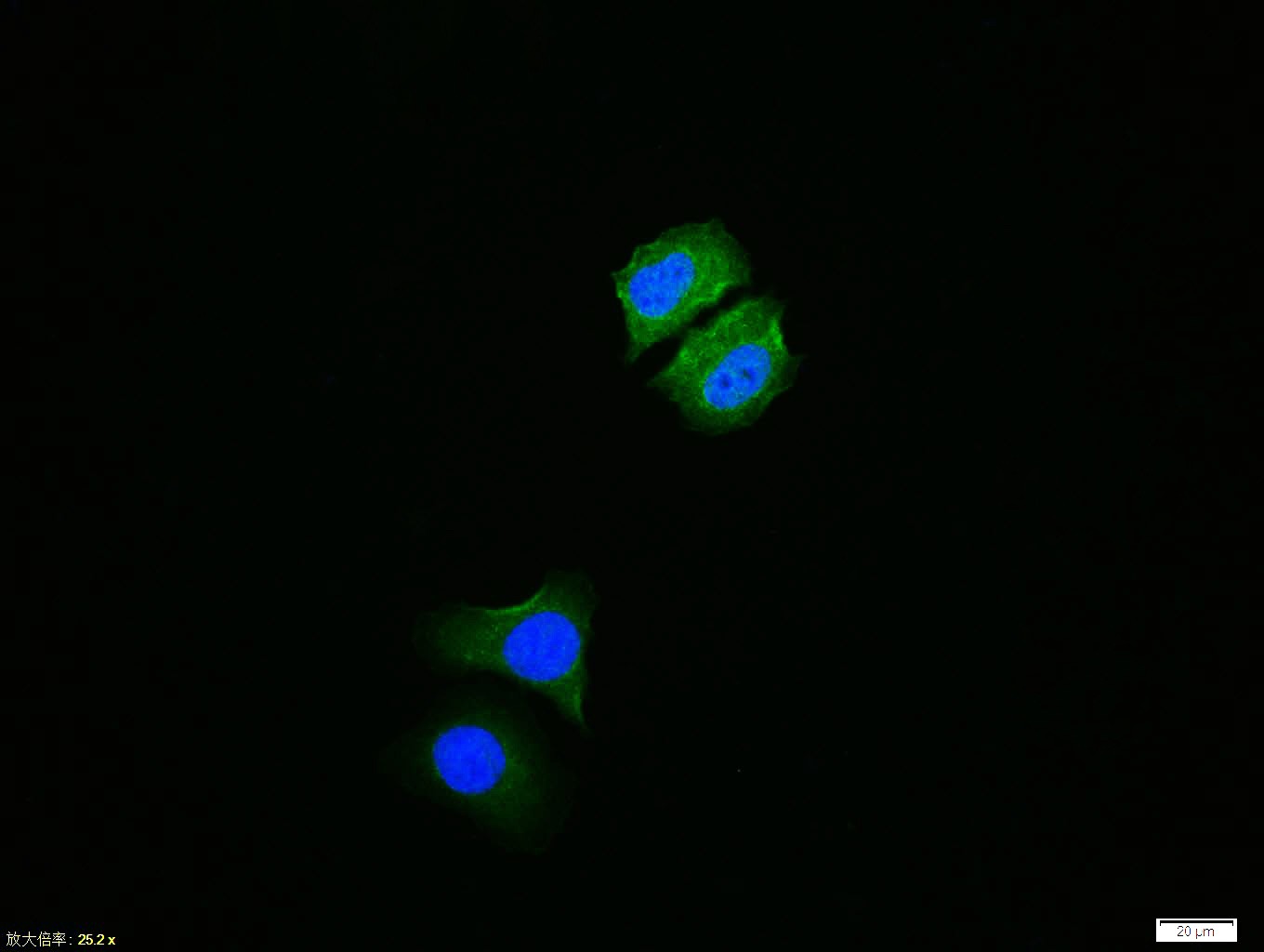 Anti-Phospho-IkB alpha/NFKBIA (Ser36) Polyclonal Antibody