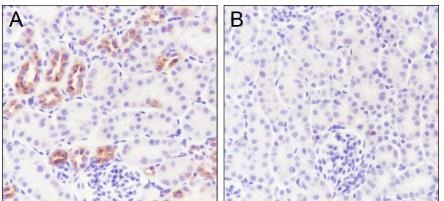 Anti-Phospho-IkB alpha/NFKBIA (Ser32, 36) Antibody (7S693)