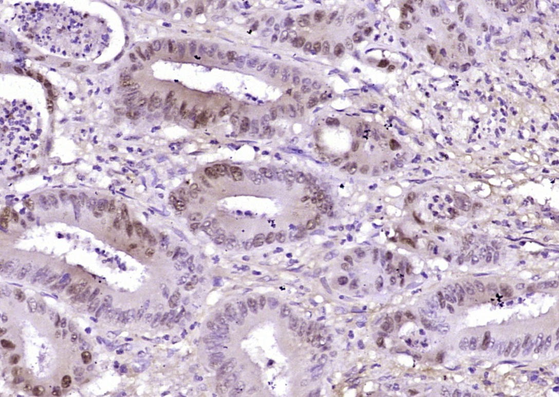 Anti-Phospho-Beta-Catenin (Ser33, 37) Polyclonal Antibody