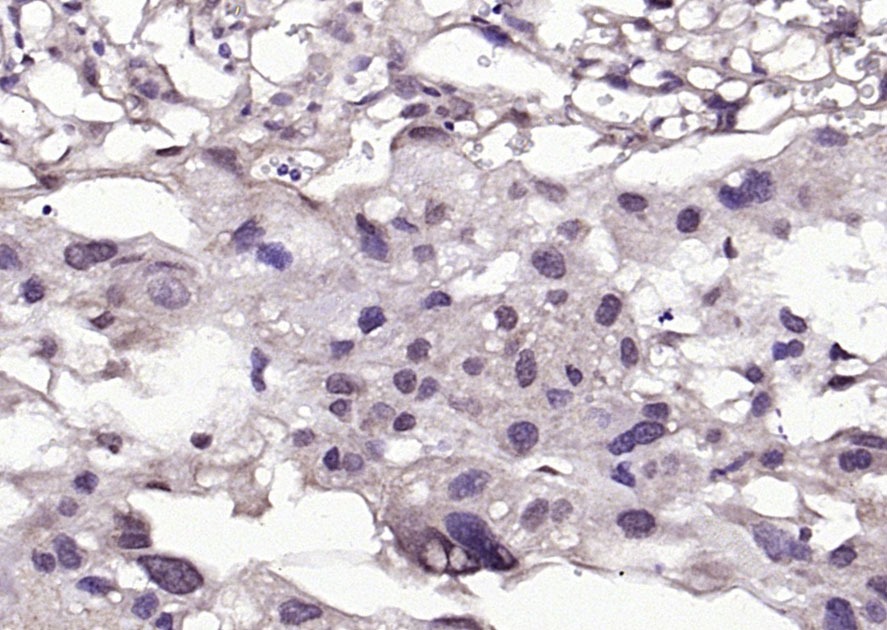 Anti-Phospho-BRAF (Ser365) Polyclonal Antibody