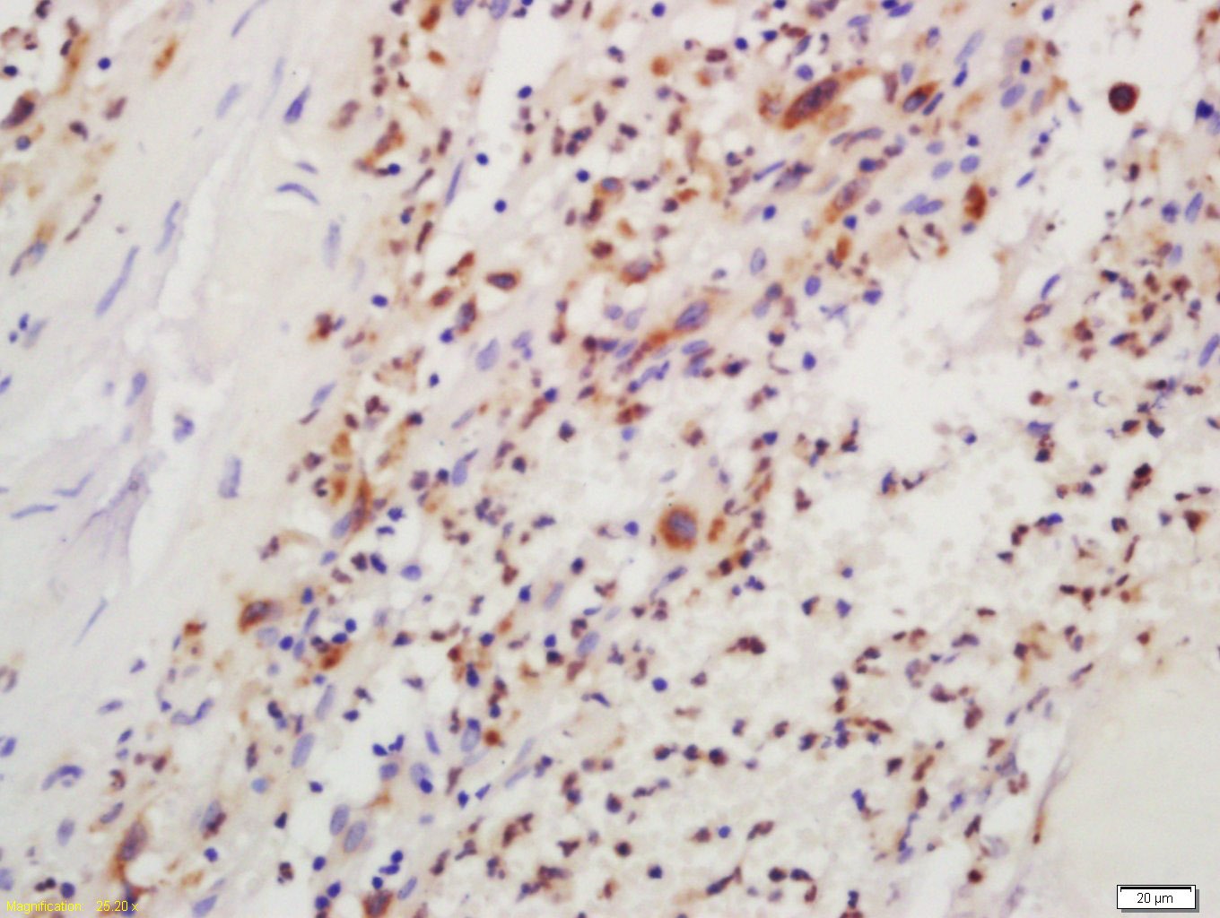 Anti-Phospho-IKBKB (Tyr199) Polyclonal Antibody