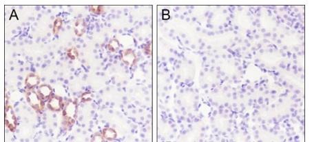 Anti-Phospho-IkB alpha/NFKBIA (Ser32, 36) Antibody (7S693)