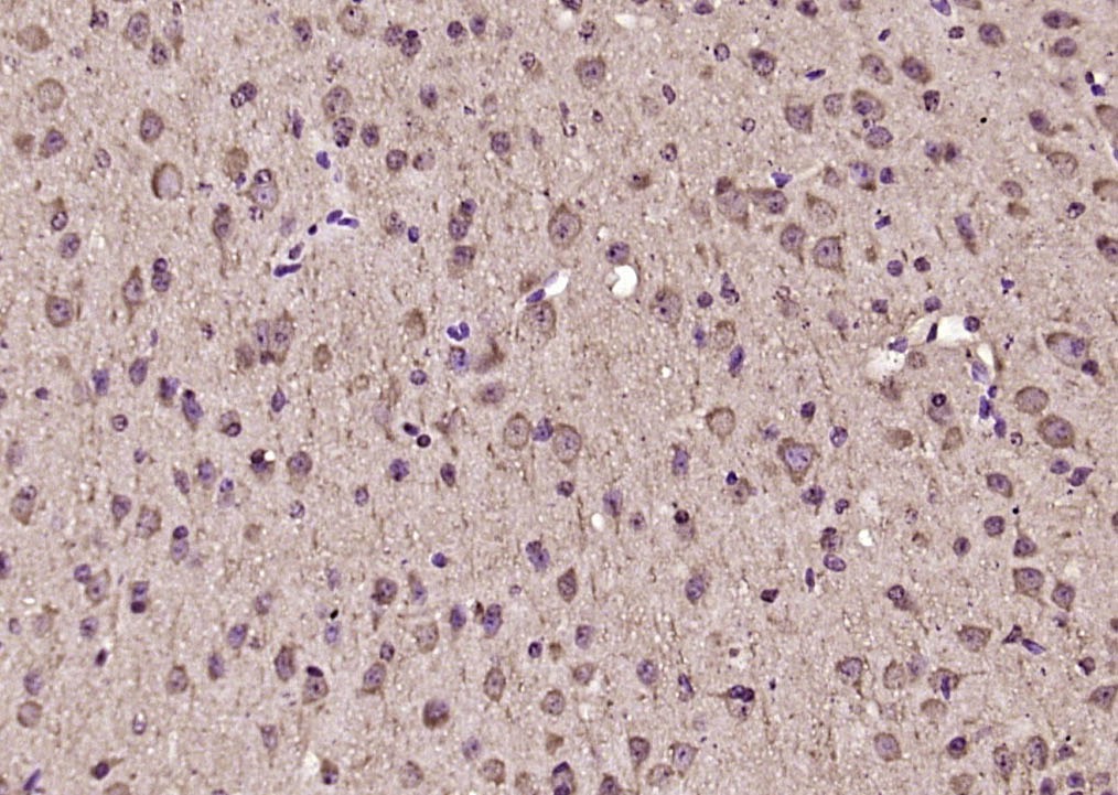 Anti-Phospho-IKBKA/IKBKB (Ser176, 180) Polyclonal Antibody