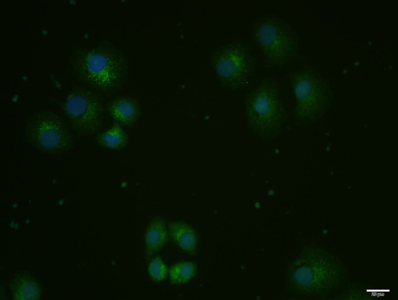 Anti-ox-LDL Polyclonal Antibody 2