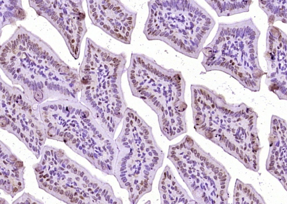 Anti-Phospho-Beta-Catenin (Ser33, 37) Polyclonal Antibody