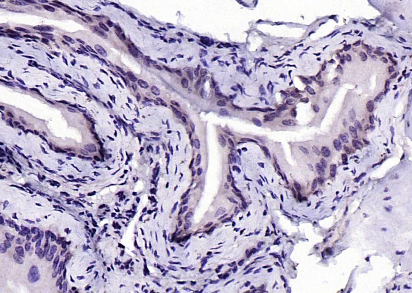 Anti-Phospho-IKBKB (Tyr199) Polyclonal Antibody