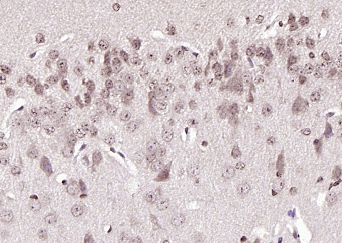 Anti-Phospho-BRAF (Ser365) Polyclonal Antibody