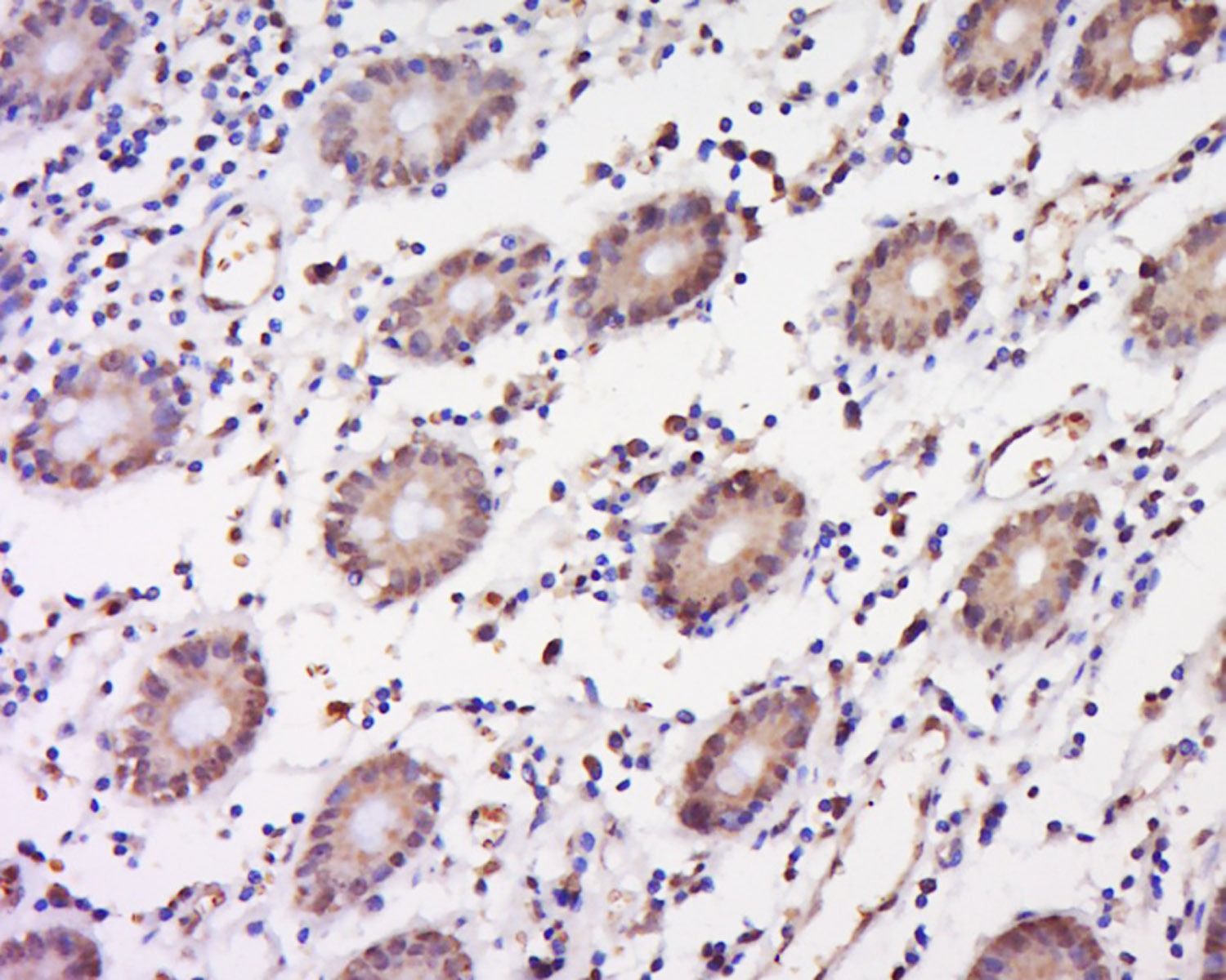 Anti-Phospho-IkB alpha/NFKBIA (Tyr305) Polyclonal Antibody
