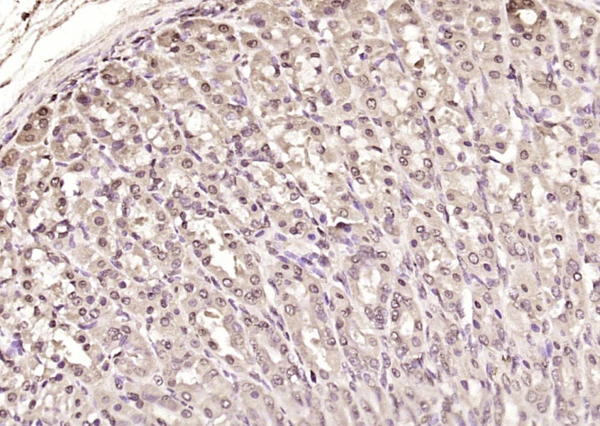 Anti-Phospho-IkB alpha/NFKBIA (Tyr305) Polyclonal Antibody