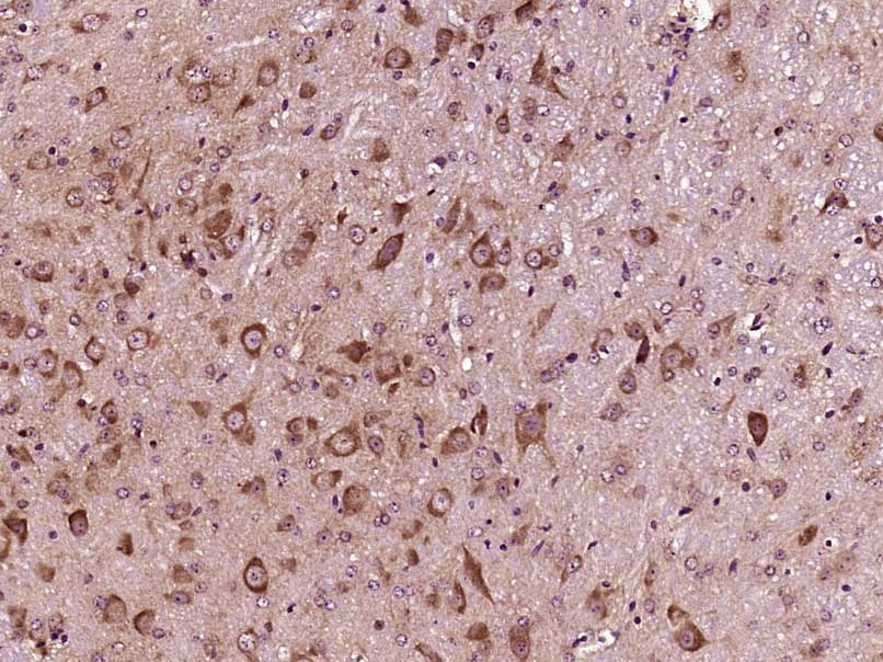 Anti-Phospho-IkB alpha/NFKBIA (Ser36) Polyclonal Antibody