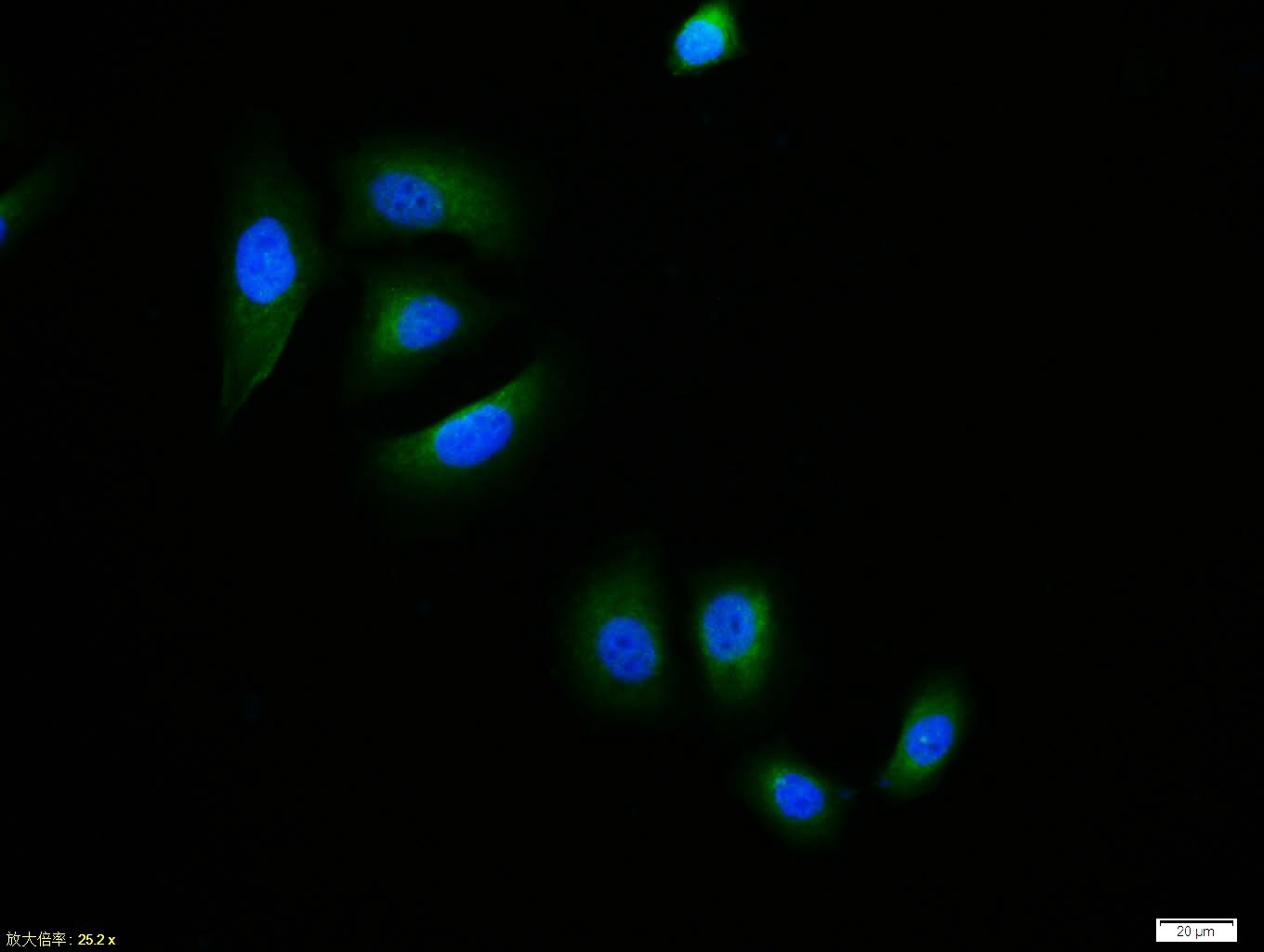 Anti-Phospho-IkB alpha/NFKBIA (Ser32, 36) Polyclonal Antibody