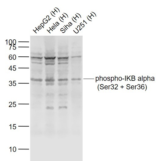 Anti-Phospho-IkB alpha/NFKBIA (Ser32, 36) Polyclonal Antibody