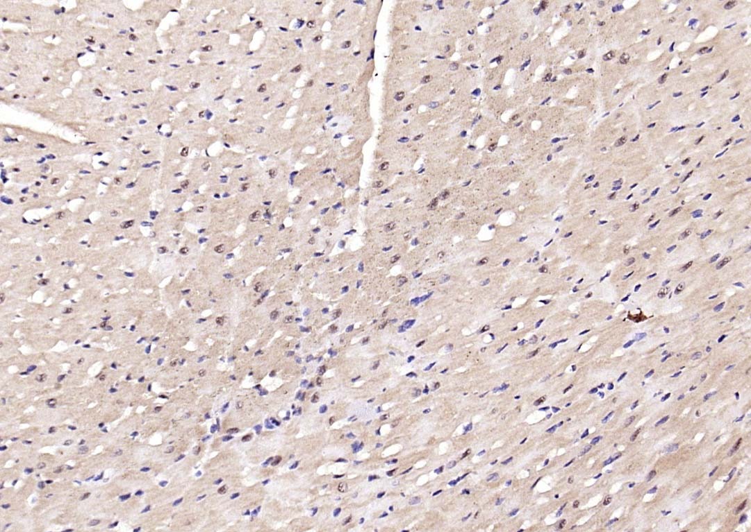 Anti-Phospho-AMPK alpha 2 (Thr172) Polyclonal Antibody