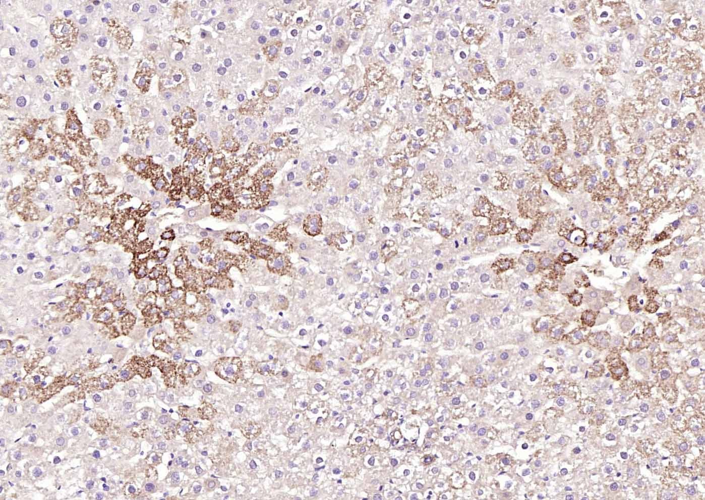 Anti-ox-LDL Antibody (4W894)