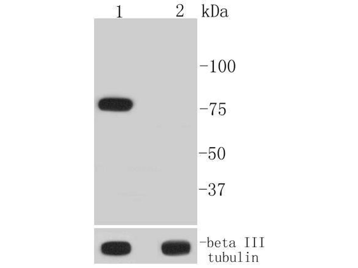 Anti-Phospho-BTK (Tyr223) Antibody (3S713)
