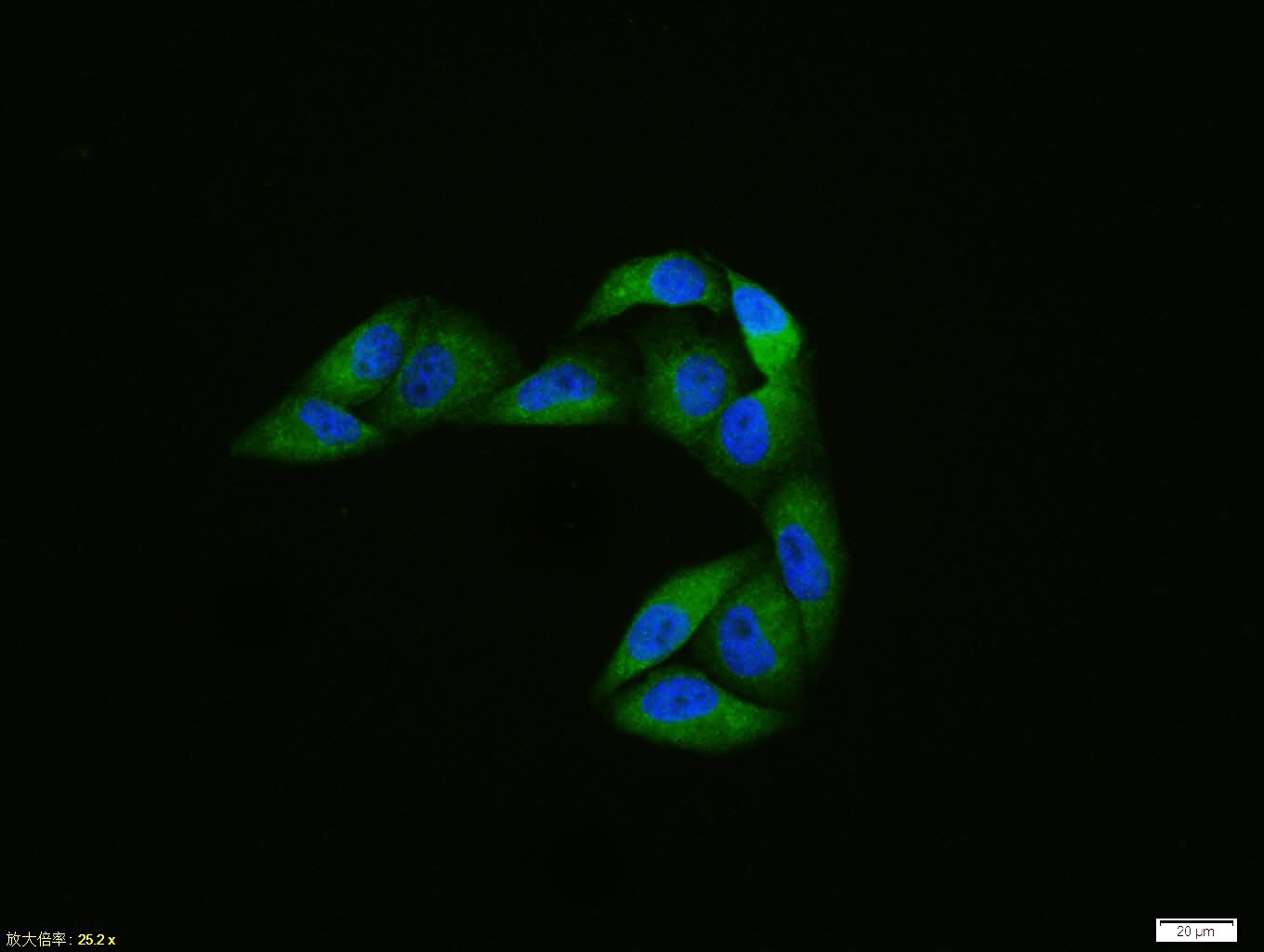 Anti-Phospho-ATG1 (Ser556) Polyclonal Antibody