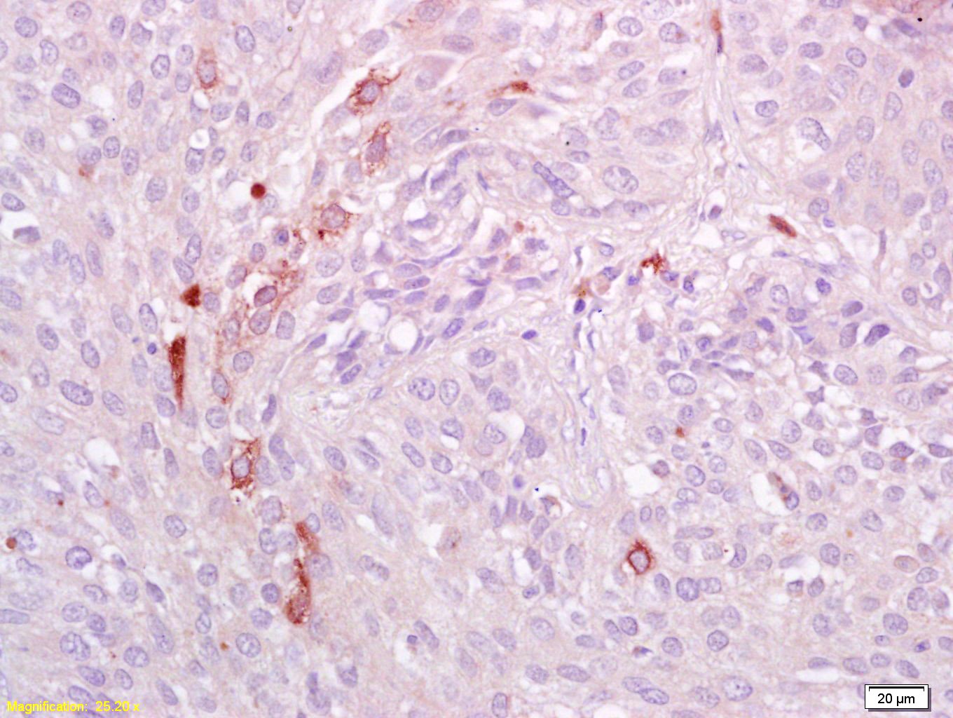 Anti-Phospho-AXL (Tyr698, 702, 703) Polyclonal Antibody