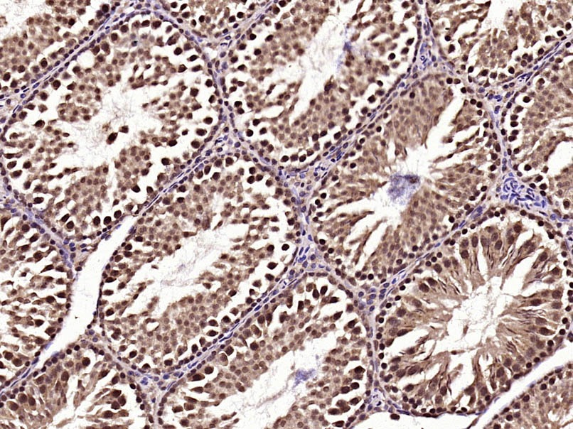 Anti-Phospho-AMPK alpha 2 (Thr172) Polyclonal Antibody