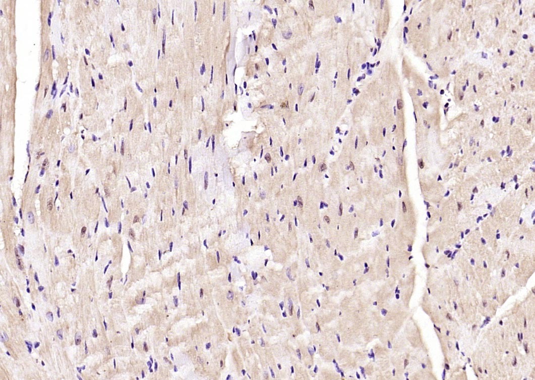 Anti-Phospho-AMPK alpha 2 (Thr172) Polyclonal Antibody