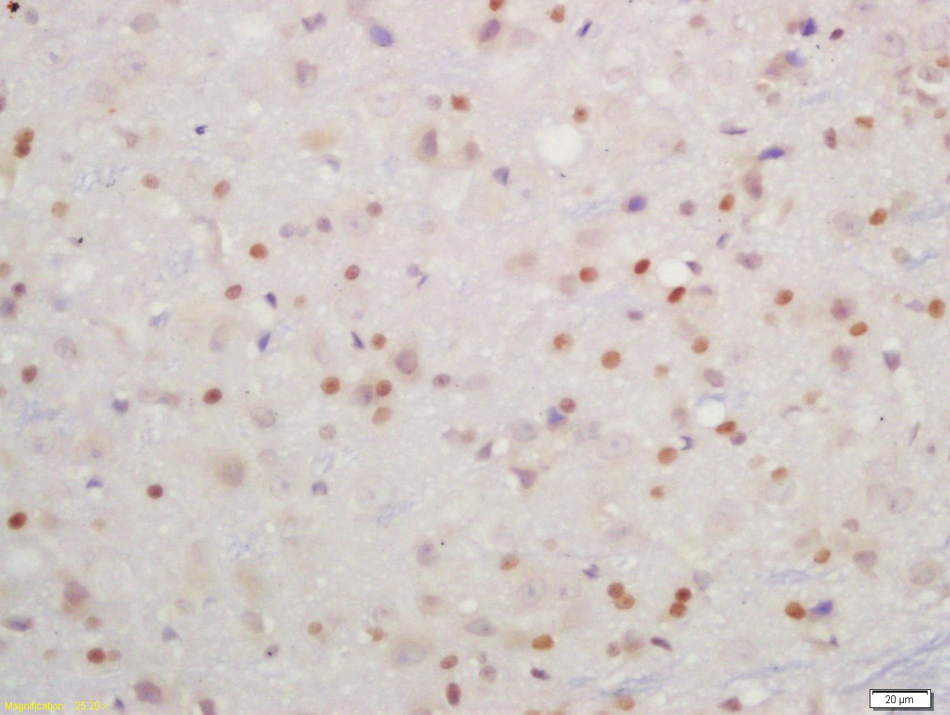 Anti-Phospho-IKBKB (Tyr199) Polyclonal Antibody