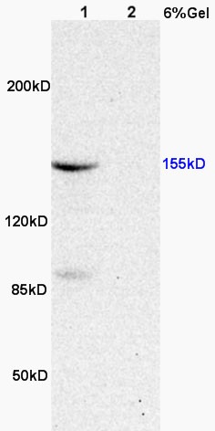 Anti-Phospho-ASK1 (Thr845) Polyclonal Antibody