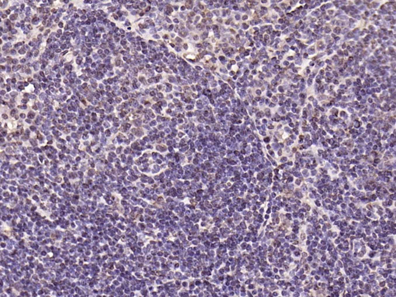 Anti-Phospho-IkB alpha/NFKBIA (Tyr305) Polyclonal Antibody